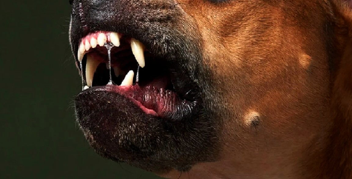 Cães da raça pitbull atacam idosa de 69 anos em Americana