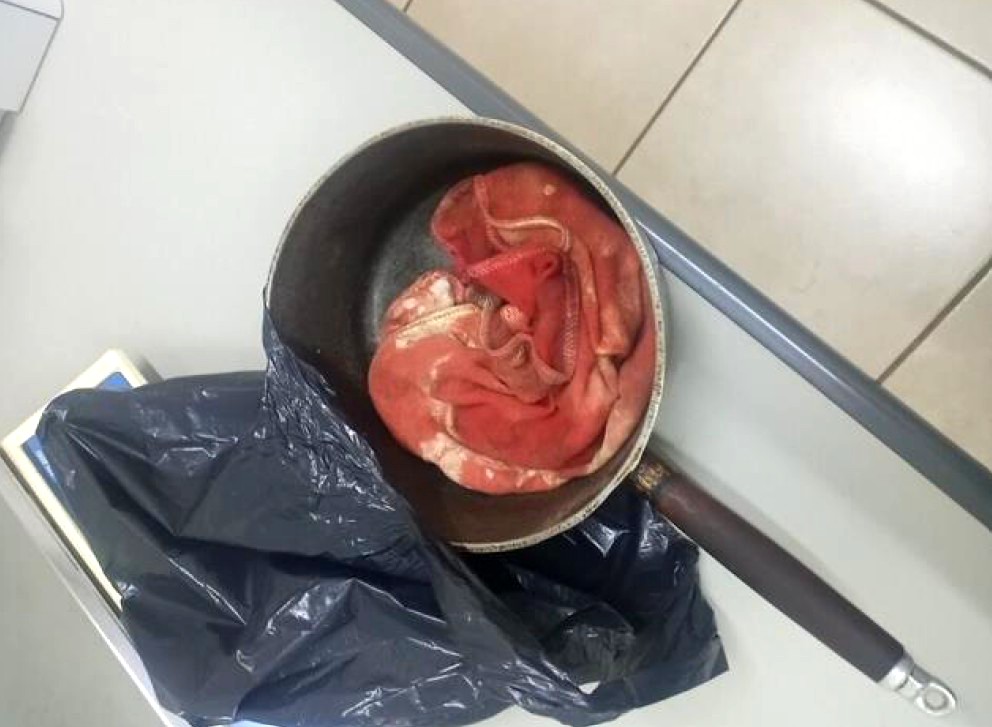 Homem agride o pai de 73 anos com panelada na cabeça em Araras